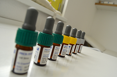 allergietestung